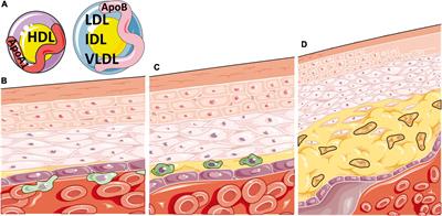 Sex Differences in Lipid Metabolism: Implications for Systemic Lupus Erythematosus and Cardiovascular Disease Risk